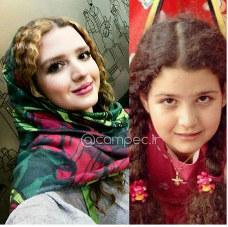 تغییر چهره روژان آریامنش بازیگر «دردسر والدین»+عکس