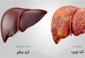 علائمی که می‌گوید کبدمان خوب کار نمی کند