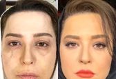 گریم بازیگر دل قبل و بعد خودکشی! +عکس