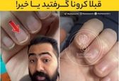 از روی ناخن‌هایتان ببینید قبلاً کرونا گرفتید یا خیر ؟! +عکس